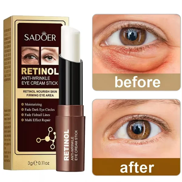 Eye Cream Removes Dark Circles, Wrinkles, fine lines.
