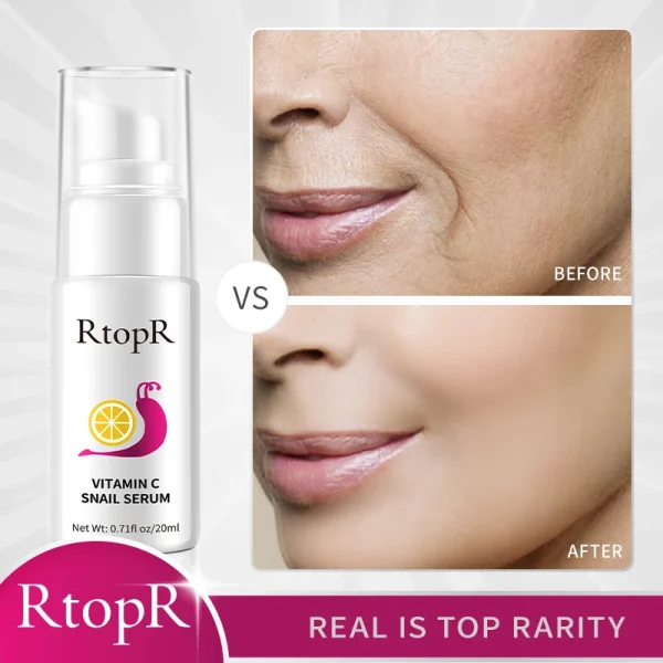 Hyaluronic Anti-Aging Serum removes wrinkles